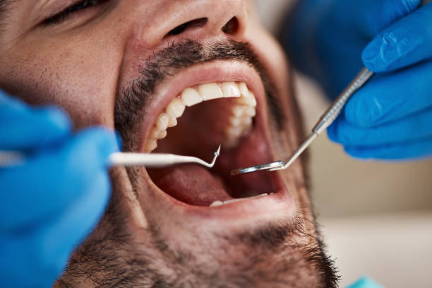 Best Emergency Wisdom Teeth Removal in Seymour, TX