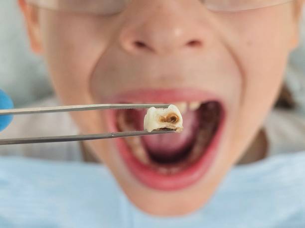 Best Weekend Emergency Dentist in Seymour, TX
